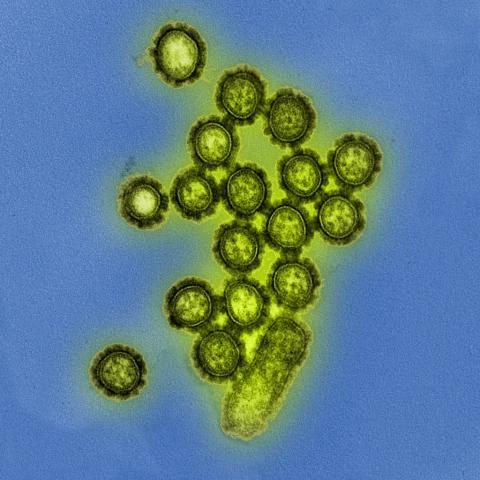 colored photo of H1N1 virus particles as viewed under a microscope