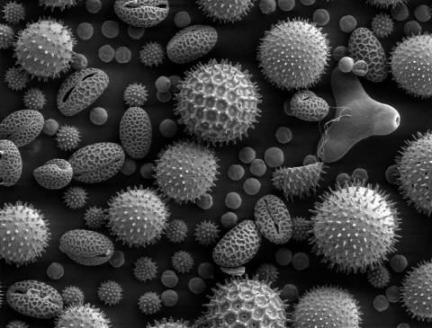 greyscale photo of tiny plants taken by an electron microscope